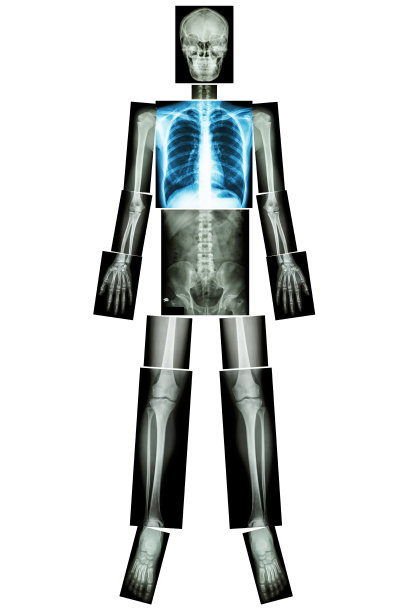 肺健康(全身x线)图片下载