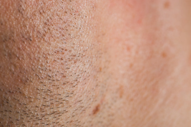 脸颊上没有刮胡子。微距与浅景深的领域。图片下载