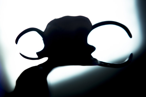 义齿部分义齿图片下载