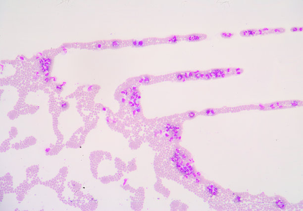 白细胞图片下载