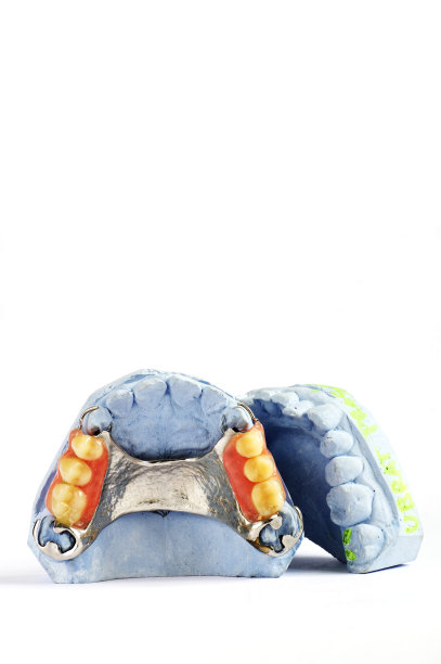 局部义齿图片下载