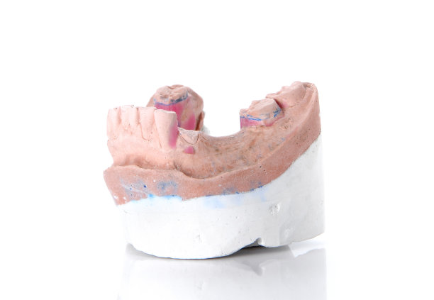 假牙模，白色背景上有断牙。图片下载