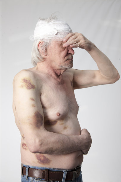 土匪残缺的人图片下载