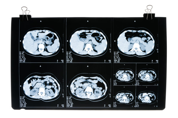 x光检查图片下载