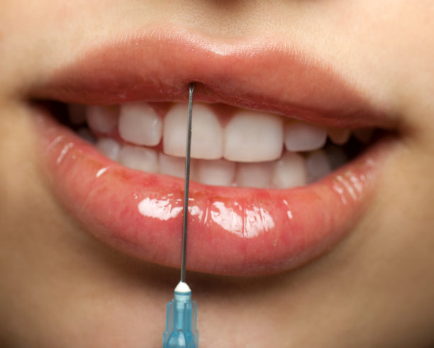 肉毒杆菌注射图片下载