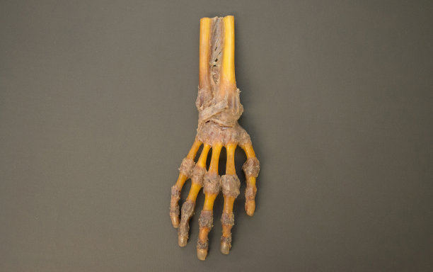 右手解剖-俯视图-高清分辨率图片下载