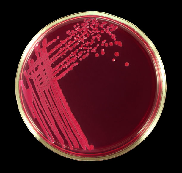 大肠杆菌乳糖阴性生长在红色琼脂Endo分离图片下载