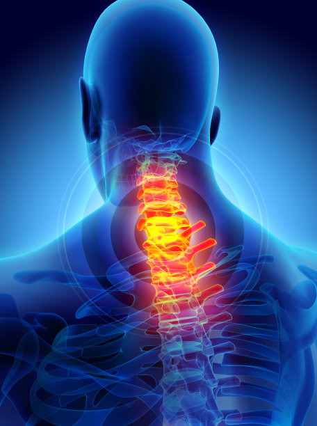颈部疼痛-颈椎骨骼x光，3D插图。图片下载