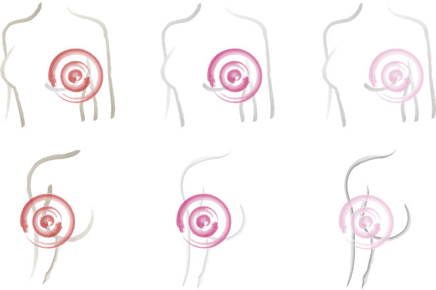 乳腺癌矢量图图片下载
