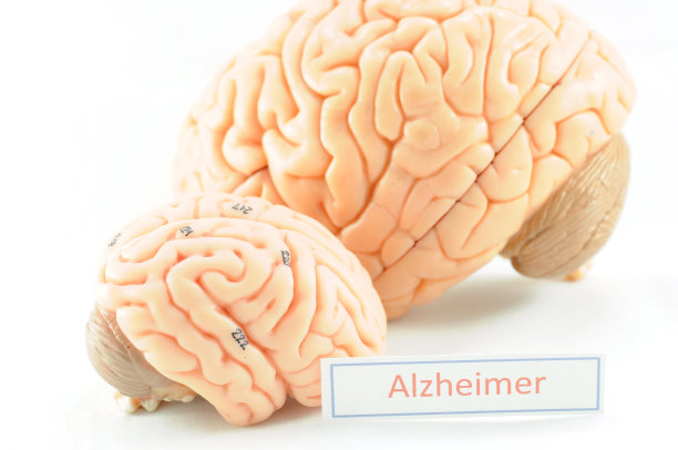人类大脑和老年痴呆症的措辞图片下载