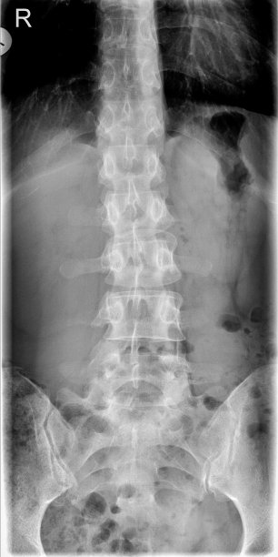 x射线图像人体脊柱图片下载
