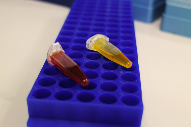 医学实验室的血尿检验样本图片下载