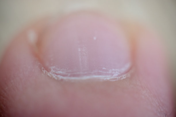 脚趾甲关闭图片下载