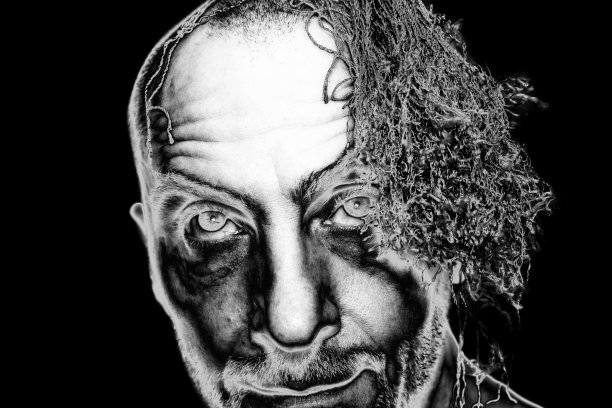 头发有问题的男人。图片下载