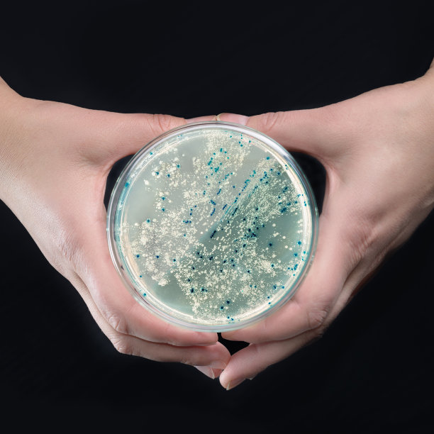 手拿有菌落的琼脂平板图片下载
