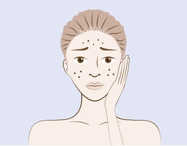 女性有痤疮皮肤问题图片下载