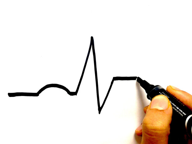 心电图画图片下载