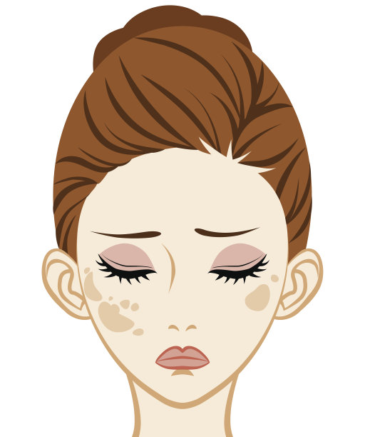 斑点-面部皮肤问题图片下载