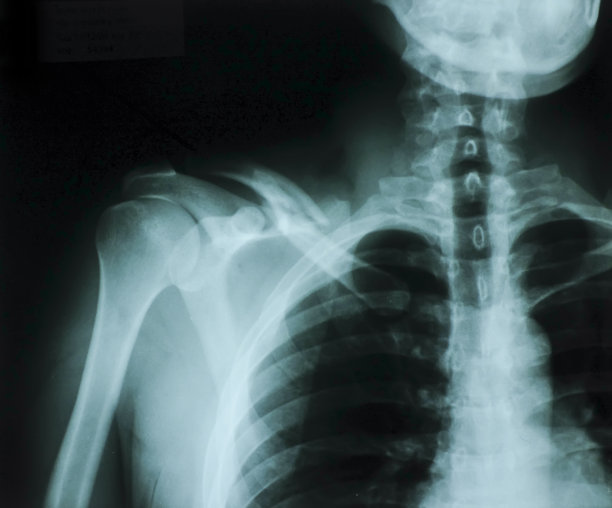 x射线用于治疗图片下载