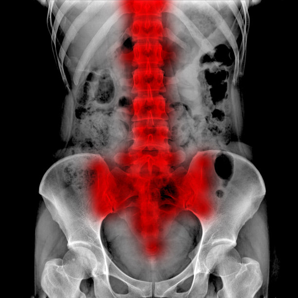 病人的x射线图片下载