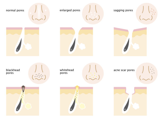 皮肤毛孔的种类素材图片