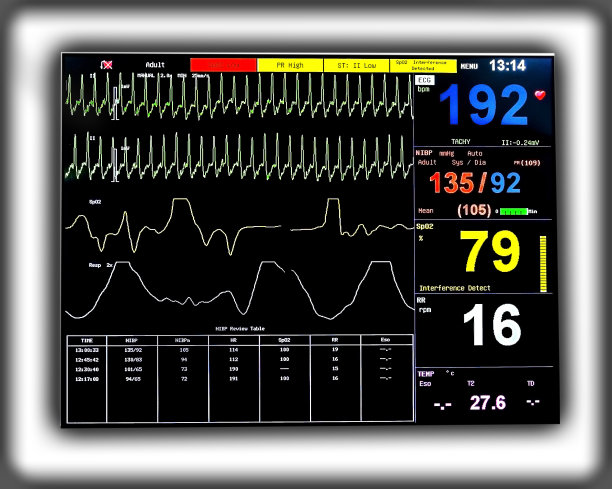 心电图监视器图片下载