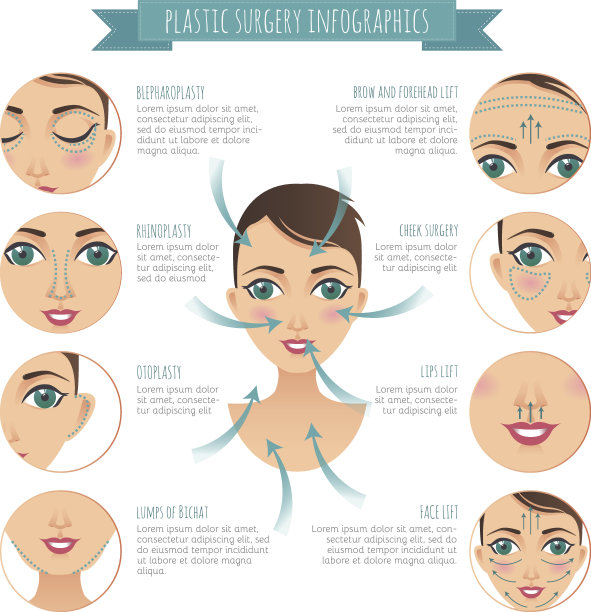 整形手术信息图。鼻整形，比查特肿块，提容术图片下载