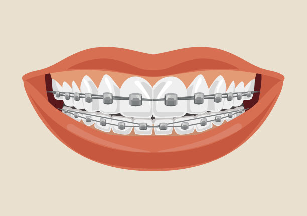 女人戴着牙套微笑着。矢量平面卡通插图图片下载