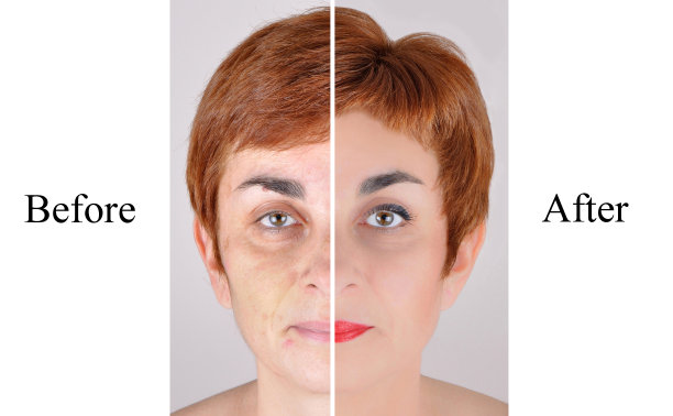 美容前后图片下载