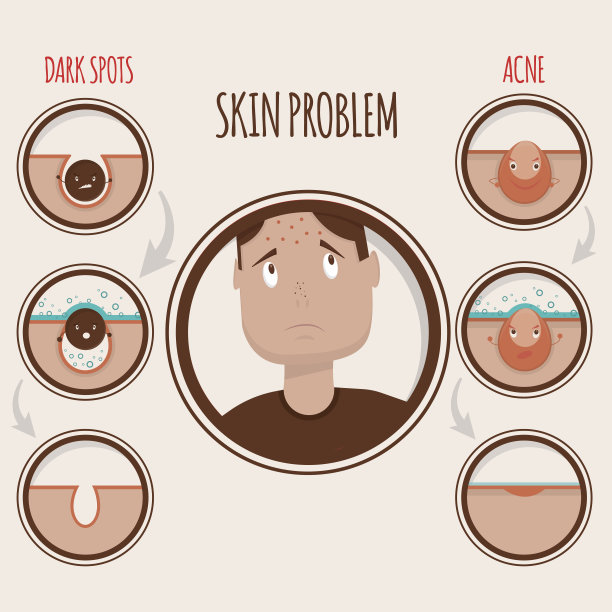 皮肤问题说明图片下载