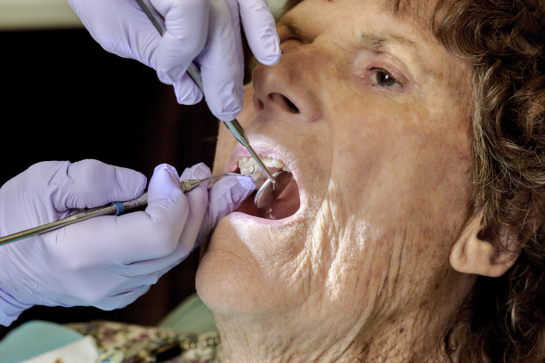 一位老妇人正在洗牙图片下载