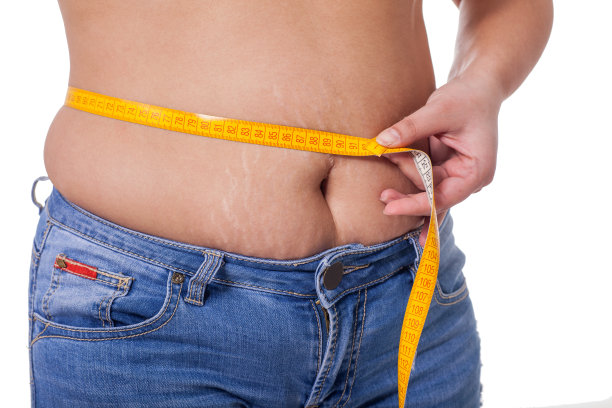 妊娠纹和脂肪团，健康生活理念图片下载