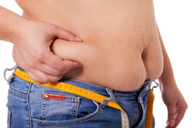 妊娠纹和脂肪团，健康生活理念图片下载