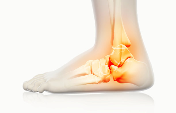 脚踝疼痛-骨骼x光片。图片下载