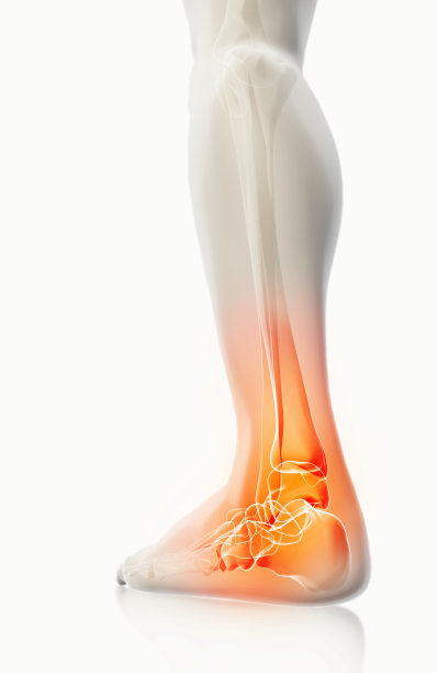 脚踝疼痛-骨骼x光片。图片下载