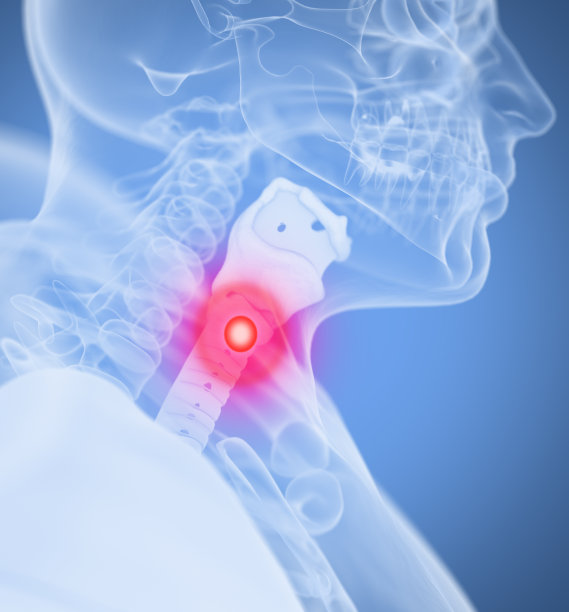 喉咙痛,疼痛。人体解剖头部像x光图像。图片下载