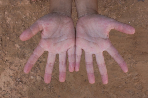 孩子的手。图片下载