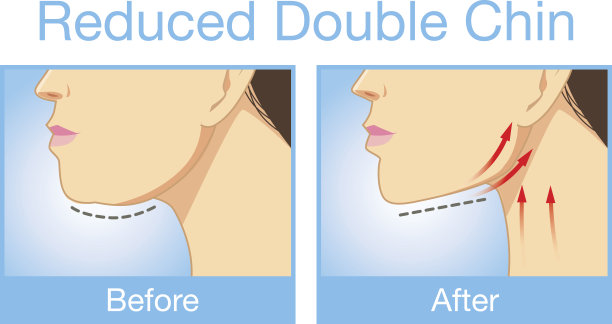 缩小双下巴图片下载