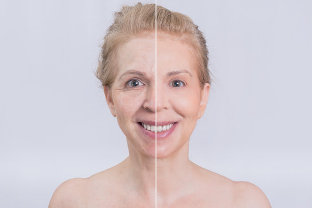 皮肤治疗前后图片下载