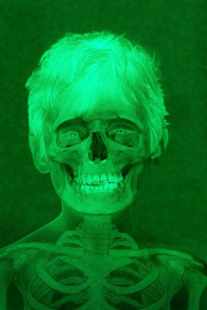 一个男孩的x光骨架。图片下载