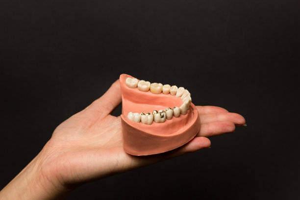 牙科修复术已备妥图片下载