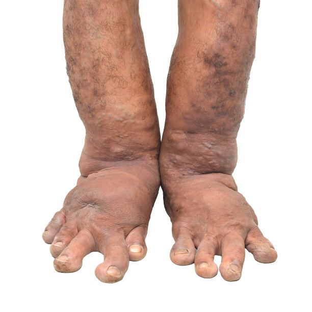 白色背景下的足部疾病图片下载