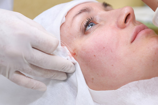 整容手术。图片下载