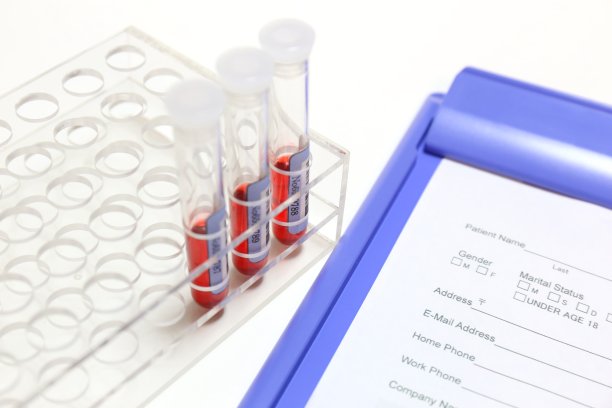 采血样本图片下载