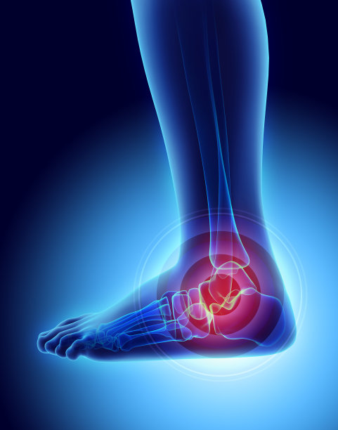 脚踝疼痛-骨骼x光片。图片下载