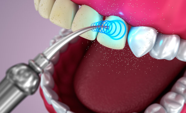 牙齿美白，医学上准确的3D插图图片下载