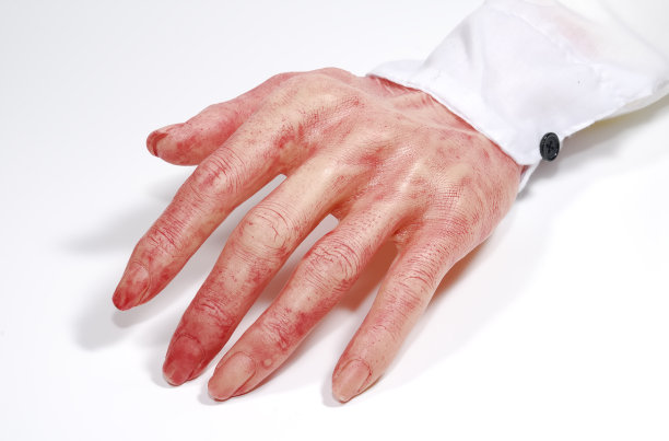 血腥的手图片下载