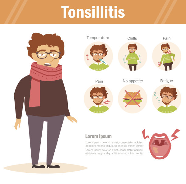 扁桃体炎。向量。卡通图片下载