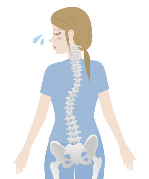 姿势不好，女性的体型轮廓和脊柱弯曲图片下载