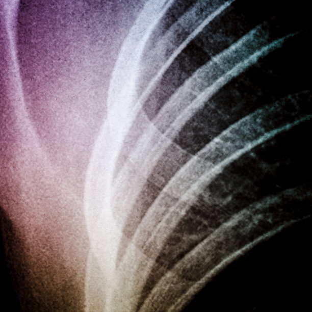 x射线的胸图片下载